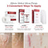 Effective Medical Silicone Therapy: 3 Convenient Ways To Apply - Scar Tape, Scar Gel, Scar Strips